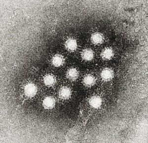 Uppförstoring av Hepatit-A virus